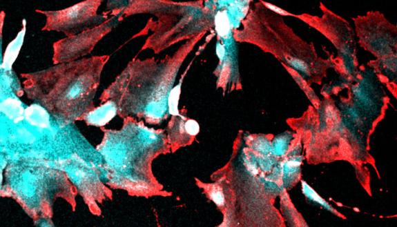 kidney cells attacked by covid