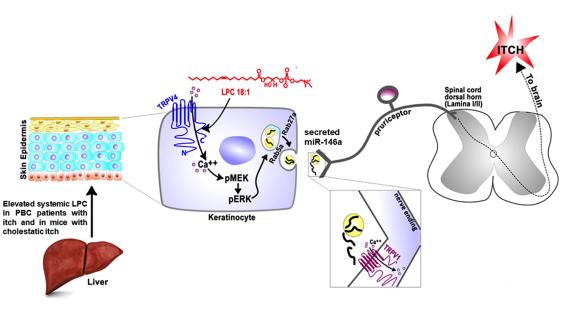 Excess lipids produced by liver failure signal an itching sensation directly to the skin cells, through a receptor called TRPV4 and a microRNA. (Wolfgang Liedtke)