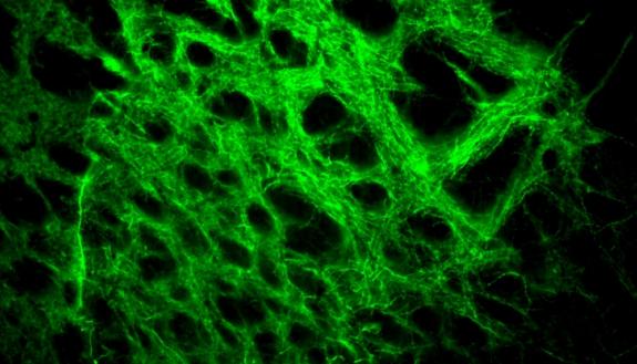 Immunofluorescence showing dense terminal projections from the subthalamic nucleus into the globus pallidus externus. The neurons glow green to prove that they have received and are expressing the Chronos optogentic machinery after delivering it to the su