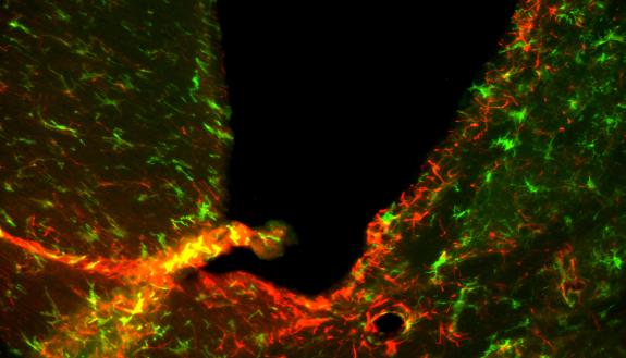 A microscope view of neurons (green) and immune cells (red) inside the brain of a mouse with a drug-resistant form of a disease closely related to MS. Courtesy of Mari Shinohara.  