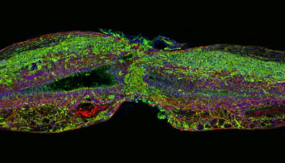 Adult zebrafish can regenerate their spinal cords after an injury. Supporting glial cells (shown in red) are first to bridge the gap between the severed ends. Neuronal cells (green) soon follow. Photo credit: Mayssa Mokalled and Kenneth Poss, Duke