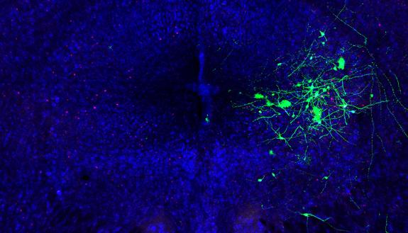 Green fluorescent proteins mark the location of neurons in the mouse’s mid-brain that are integral to vocalizations for wooing. (Mooney Lab, Duke)