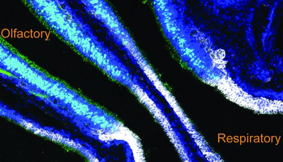 Circulating antibody (white) is prevented from accessing olfactory epithelium (green) by a previously unknown blood-olfactory barrier, the BOB. (Ashley Moseman Lab, Duke University)