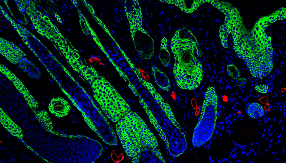 The image shows regenerated hair follicles at the center of a wound. The hair follicles appear as tear drop structures, and they have Keratin 5 positive tips, which appear in green.