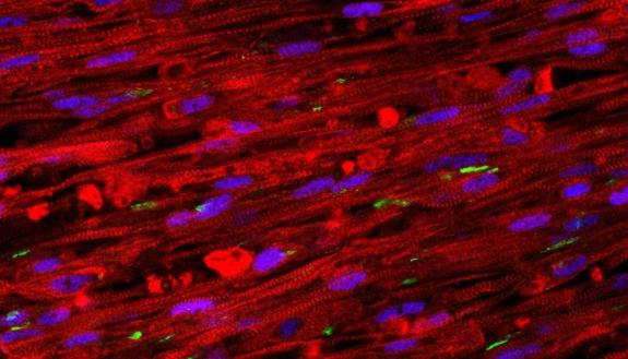 A stained cross section of the new muscle fibers. The red cells are striated muscle fibers, the green areas are receptors for neuronal input, and the blue patches are cell nuclei. (Credit: Bursac Lab)