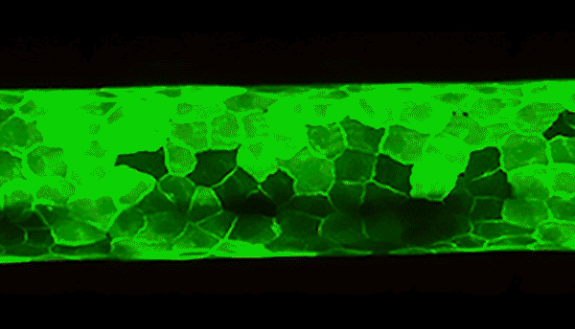 Our spines begin as a flexible column called the notochord. Over time, cells on the notochord surface divide into alternating segments that go on to form cartilage and vertebrae.