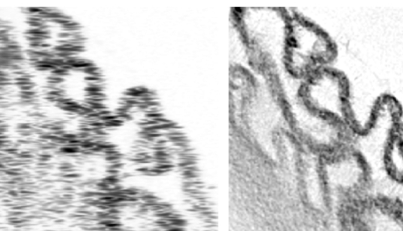 photos of cells in OCRT study