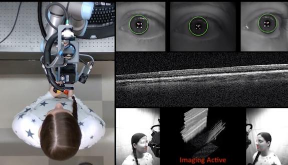 Duke’s newly developed OCT scanner is attached to a robotic arm that can move the scanner to perfectly align with a patient’s eyes. The scanner requires less than 10 seconds to scan and image each eye.