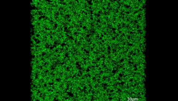 The partially ordered protein forms a stable, porous scaffold that can rapidly integrate into tissue and promote the formation of blood vessels.