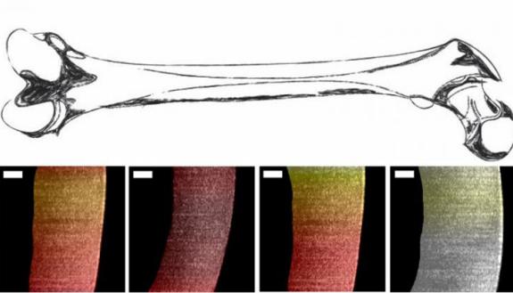 Researchers used a new endoscopic OCT system to visualize variances in pig cartilage thickness. The image shows a sketch of a femur and processed OCT images with thin regions shown in dark red and thicker regions more yellow and white. Scale bar is 250 mi