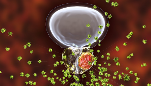 image of prostate cancer cell