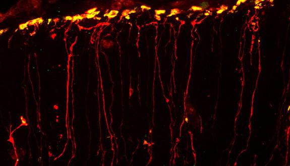 RNA (yellow) moves quickly toward the uppermost layer of the brain along the path of neural stem cells (red). Credit - Louis-Jan Pilaz, Duke University
