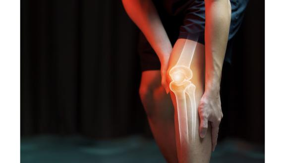Duke researchers have developed a gel-based cartilage substitute to relieve achy knees that’s even stronger and more durable than the real thing. Clinical trials to start next year. Credit: Canva