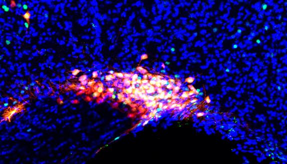 microscope image of supraoptic nucleus of the brain