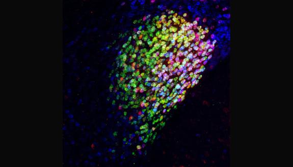 Neuron cells in the central amygdala of a mouse brain. Red, magenta and yellow cells (but not green or blue) are parts of a collection of neurons called the CeAga that has potent pain-suppression abilities. (Fan Wang Lab)