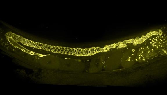 An image taken of the adult gonad structure of a C. elegans worm in the Sherwood Lab,