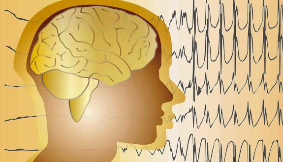 Robot Reduces Need for open Brain Surgery to Map Epileptic Seizures