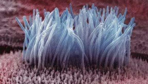 Cilia on the surface of a cell. Image from MedicalXpress.