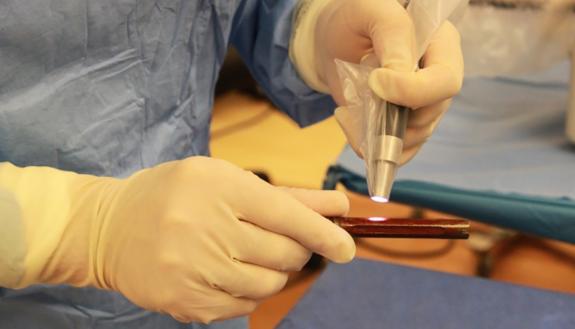 The mixture of self-assembling polymers and antibiotics is cured on human intramedullary hip implants using a handheld light source.