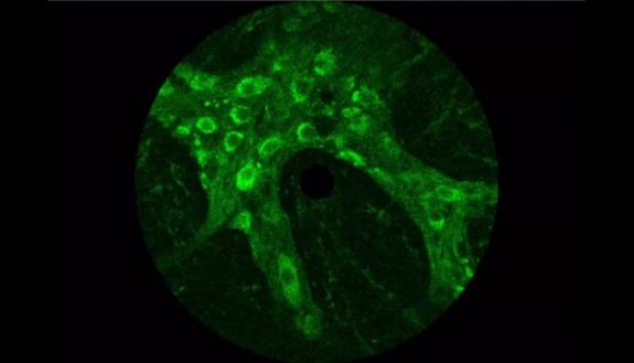 A microscopic view of neurons running through the colon with individually activated cells