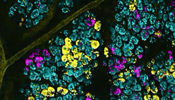 the rainbow of fluorescent stem cells reveals the cellular and molecular dynamics of pre-cancerous events.