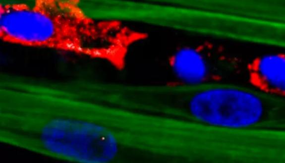 Macrophages (red) and muscle stem cells (white) within an engineered skeletal muscle tissue disrupted along mature, contractile myofibers (green). Following injury, the macrophages rescue the myofibers from cell death and muscle stem cells activate and co