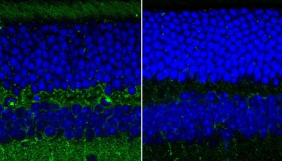 A fluorescence image of retinal layers taken with a confocal microscope from wild, healthy mice (right) and mice genetically bred to show symptoms of Alzheimer’s disease (left). The green represents amyloid deposits that are thought to correlate with Alzh