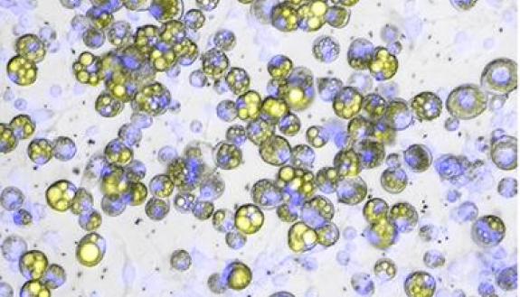 Microscopy images show fat cell development following exposure to a potent  weight-gain pharmaceutical (left), compared to fat cell development after exposure to fracking wastewater. Credit: Chris Kassotis, Duke Univ.