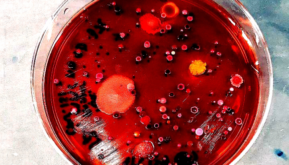A growth plate tests different strains of antibiotic resistant and pathogenic bacteria tests their ability to digest lactose