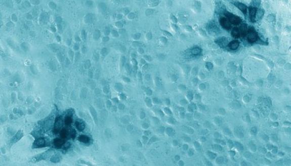 zika virus
