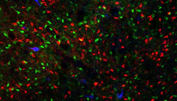A genetically altered mouse that excessively washes its face shows an imbalance in brain activity involved in compulsive behavior. Cells responsible for driving particular behaviors are more active in these mice. A Duke study found that blocking a brain 