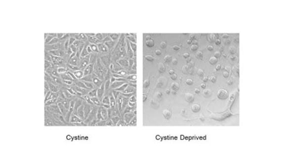 The majority of kidney cell carcinomas are missing the VHL tumor-suppressor gene. Duke researchers showed that these renal cancer cells remain healthy when all nutrients are present (left panel), but quickly swell up and die of necrosis when deprived of 