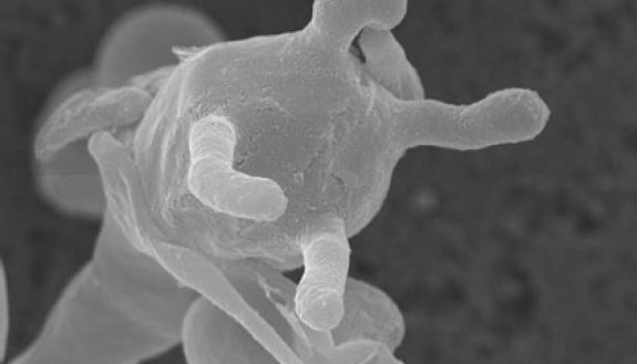 Spores on the surface of a fruiting structure from the fungus Cryptococcus deuterogattii, a deadly strain that emerged in the Pacific Northwest. (Credit: Edmond Byrnes III, Joseph Heitman -- Duke Department of Molecular Genetics and Microbiology; Valerie