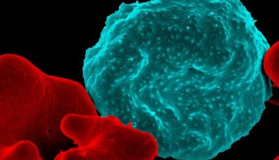 The malaria parasites growing inside this infected red blood cell (blue) will eventually burst out in unison with millions of other parasites lurking in red blood cells around them. This feat of timing is coordinated by the parasite’s internal clock. NIH.