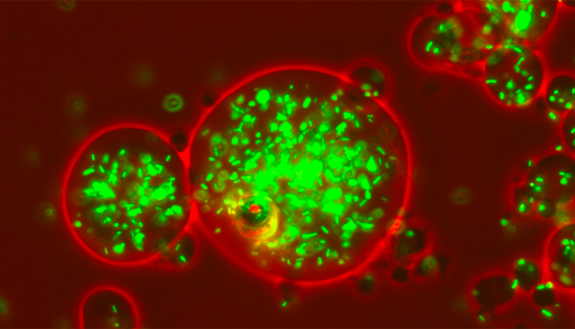 A new method for identifying strains of bacteria and guessing their resistance to antibiotics uses an AI model to analyze their growth dynamics in culture.