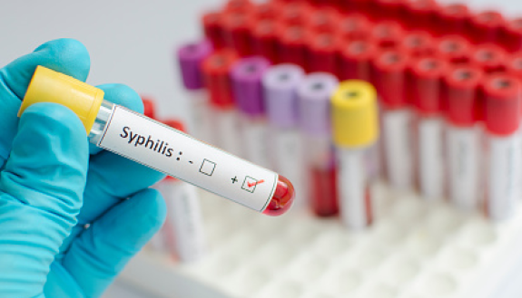 A  new international, multi-university center co-led by the Duke Human Vaccine Institute and the University of Connecticut aims to develop a vaccine for syphilis.