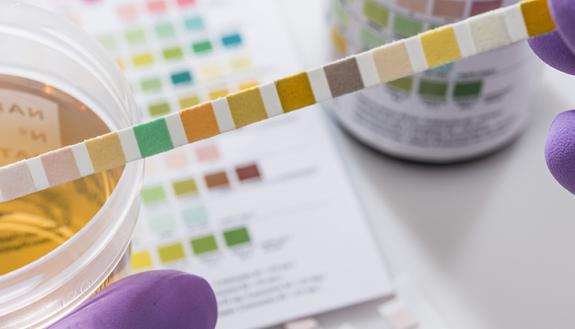 photo of urinary test swab