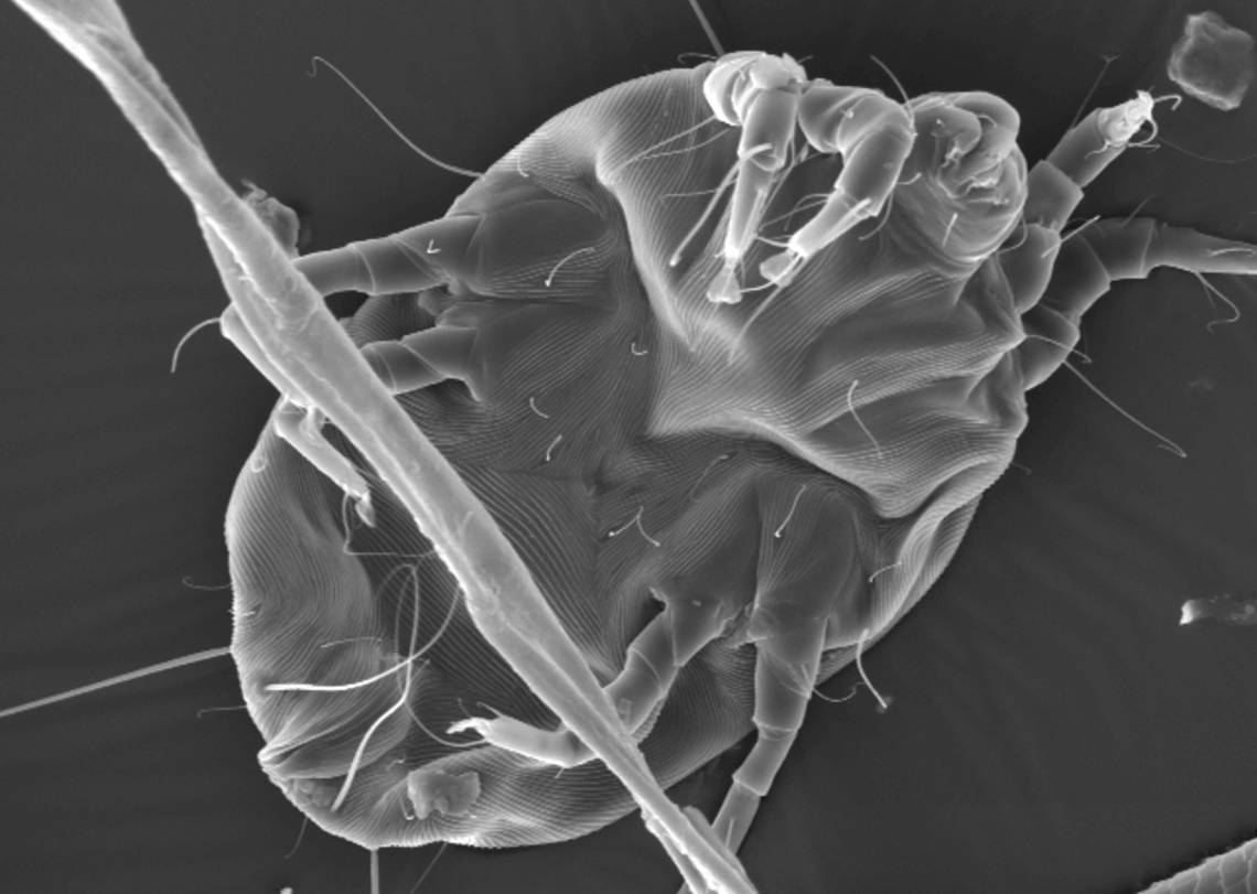 Dust Mite Allergens Share Rare Combo of Qualities Duke Today